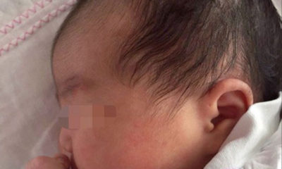 ၁၈ နှစ်ကြာ အေးခဲထားသည့် သန္ဓေသားမှ မွေးဖွားခဲ့သည့် ကလေးငယ်အား တွေ့ရစဉ် (ဓာတ်ပုံ- အင်တာနက်)