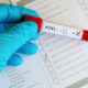 H1N1ဗိုင်းရပ်စ်ပိုး ရှိနေသည့် ဆေးစစ်ချက်တစ်ခုအားတွေ့ရစဉ် (ဓါတ်ပုံ-အင်တာနက်)