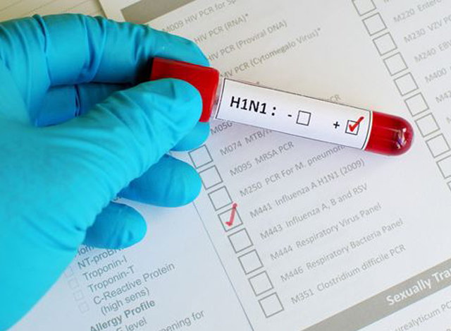 H1N1ဗိုင်းရပ်စ်ပိုး ရှိနေသည့် ဆေးစစ်ချက်တစ်ခုအားတွေ့ရစဉ် (ဓါတ်ပုံ-အင်တာနက်)