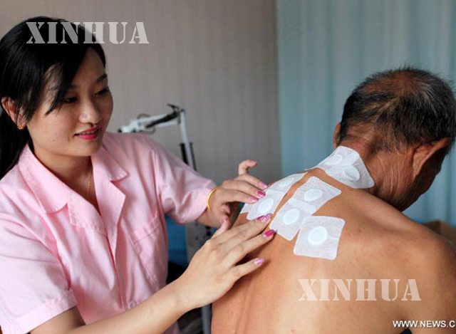 တရုတ္ရိုးရာေဆးပညာကုထံုး ျဖင့္ လူနာတစ္ဦးအား ကုသေပးေနစဥ္ (ဆင္ဟြာ)