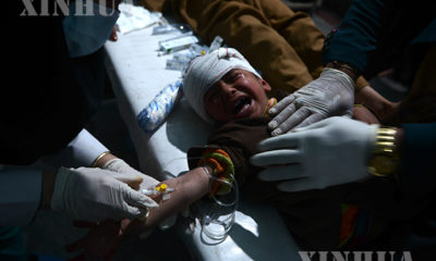 အာဖဂန်နစ္စတန်နိုင်ငံ ဟီရတ်မြို့ ဆေးရုံတစ်ခုတွင် ဒဏ်ရာရရှိသည့် ကလေးငယ်တစ်ဦး ဆေးကုသမှုခံယူနေသည်ကို မတ် ၁၃ ရက်က တွေ့ရစဉ်(ဆင်ဟွာ)